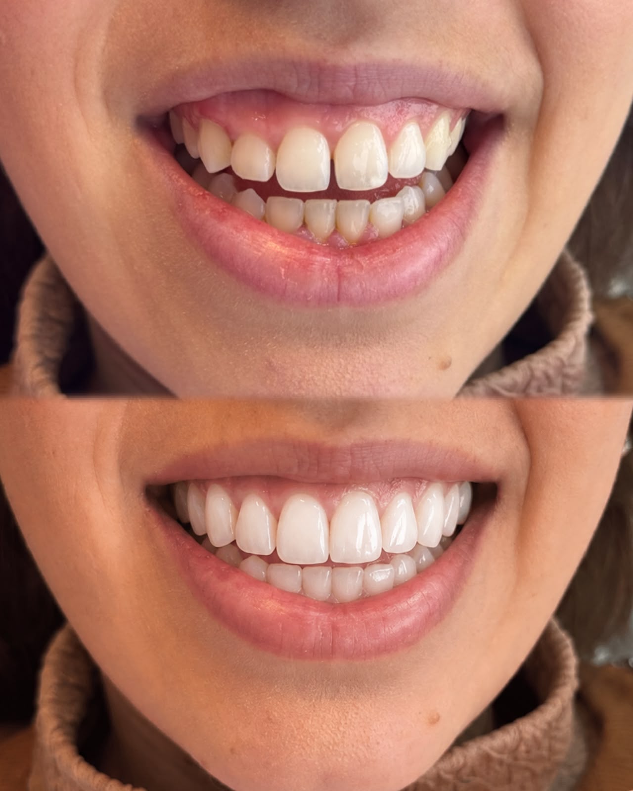 Sorriso